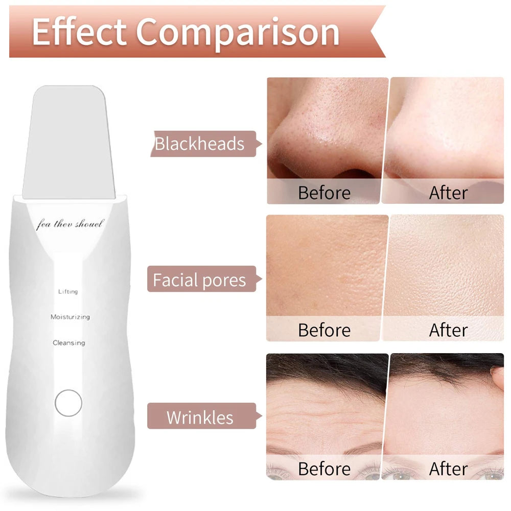 Ultrasonic Glow Skin Scrubber