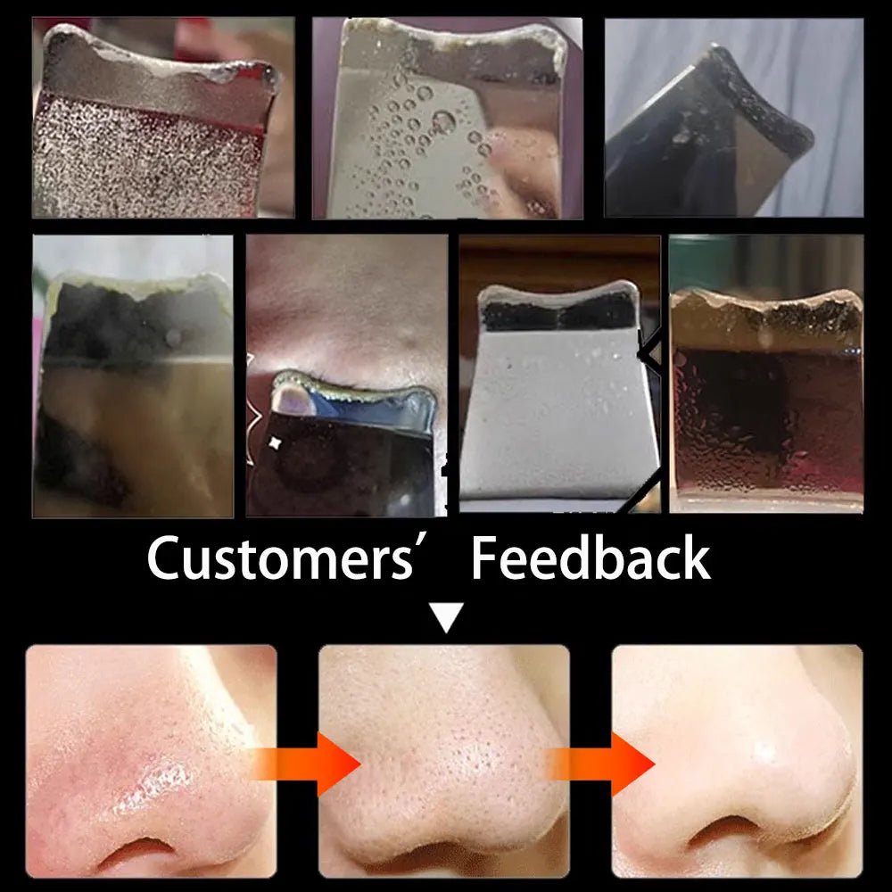 Ultrasonic Glow Skin Scrubber