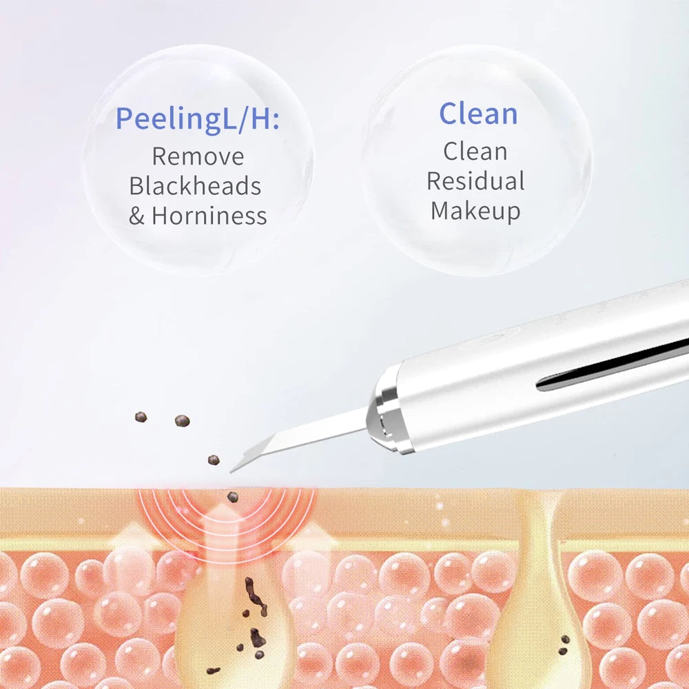 Ultrasonic Glow Skin Scrubber